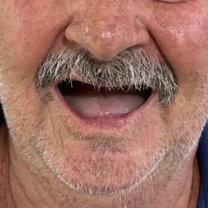 01-ANTES-qlsiupuvtpm3igs61kt2b9txp0qgf84upcqnjc2rsc