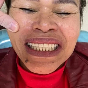 04-DEPOIS-qlsiugghxd98ad5tkgqsmc7br60sa93jc27sqkgpik